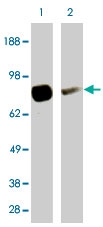 PAB10404 - SMO