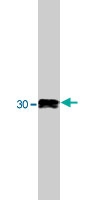 PAB10406 - SR-beta