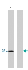 PAB10412 - PPP1CB