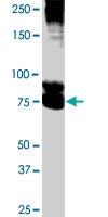 PAB1083 - DPP10 / DPRP3