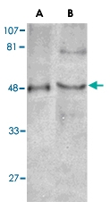 PAB1087 - TTRAP
