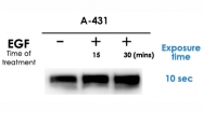 PAB10949 - EGFR / ERBB1
