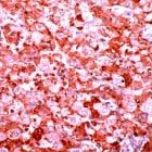 PAB11180 - Alpha-fetoprotein / AFP