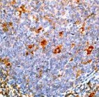 PAB11181 - Alpha-1-antichymotrypsin / ACT