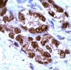 PAB11186 - Androgen receptor