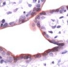PAB11187 - Annexin A1 / ANXA1
