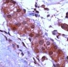 PAB11191 - APAF1