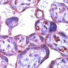 PAB11201 - ABL1