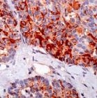 PAB11205 - CGRP / CALCA