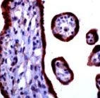 PAB11206 - CaSR