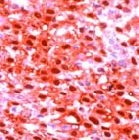 PAB11207 - Calretinin