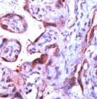 PAB11211 - Caspase-1
