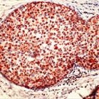 PAB11216 - Cathepsin D