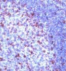 PAB11224 - CD2
