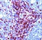 PAB11231 - CD5
