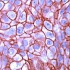 PAB11240 - CD340 / ERBB2 / HER2
