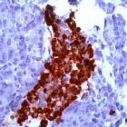 PAB11242 - Chromogranin A