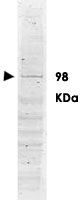 PAB11246 - DNA polymerase kappa