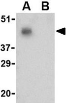 PAB11249 - CD279 / PD1