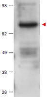 PAB11251 - PRKCB