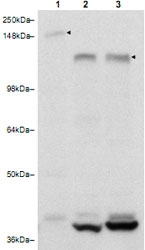 PAB11253 - RAB11FIP3