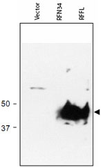 PAB11254 - RFFL / RNF189