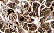 PAB11254 - RFFL / RNF189