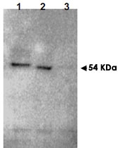 PAB11256 - RNF25