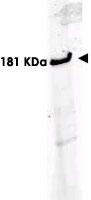 PAB11258 - ROBO1