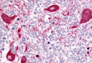 PAB11258 - ROBO1