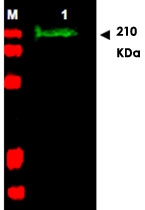 PAB11259 - SLIT2