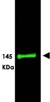 PAB11260 - SLIT3