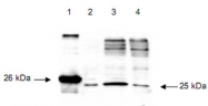 PAB11261 - DIABLO / SMAC