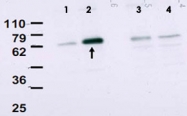 PAB11262 - SMAD2