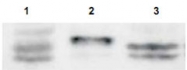 PAB11269 - Sprouty homolog 4 / SPRY4