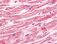 PAB11269 - Sprouty homolog 4 / SPRY4