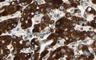 PAB11269 - Sprouty homolog 4 / SPRY4