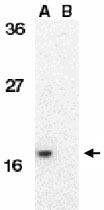 PAB11271 - IAP4 / BIRC5