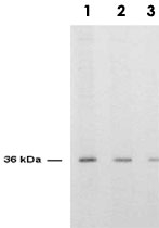 PAB11275 - Thymidylate synthase (TS)