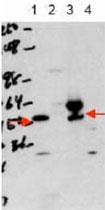 PAB11276 - THRA / ERBA1
