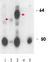 PAB11277 - THRB / ERBA2