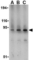 PAB11279 - CD281 / TLR1