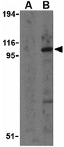 PAB11280 - CD282 / TLR2