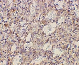 PAB11280 - CD282 / TLR2