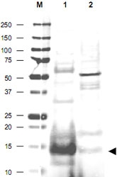 PAB11286 - UBE2N / BLU