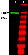 PAB11287 - UBE1 / UBA1