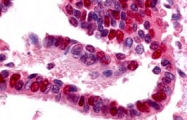PAB11287 - UBE1 / UBA1