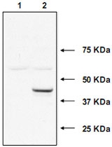 PAB11288 - UBE2J1