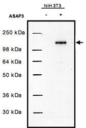 PAB11289 - DDEFL1
