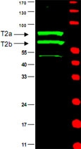 PAB11292 - Cyclin T2